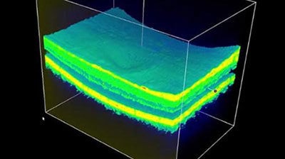 Optical coherence tomography scan